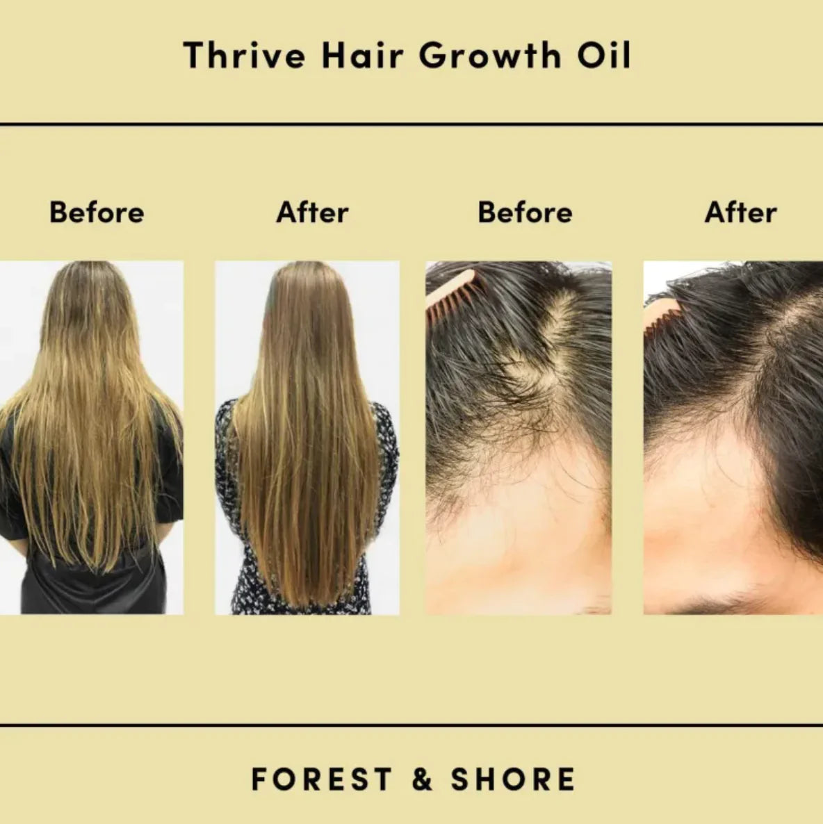 Botanical Essence | Rosemary & Green Coffee Hair Elixir
"Wake up your roots. Fuel your growth